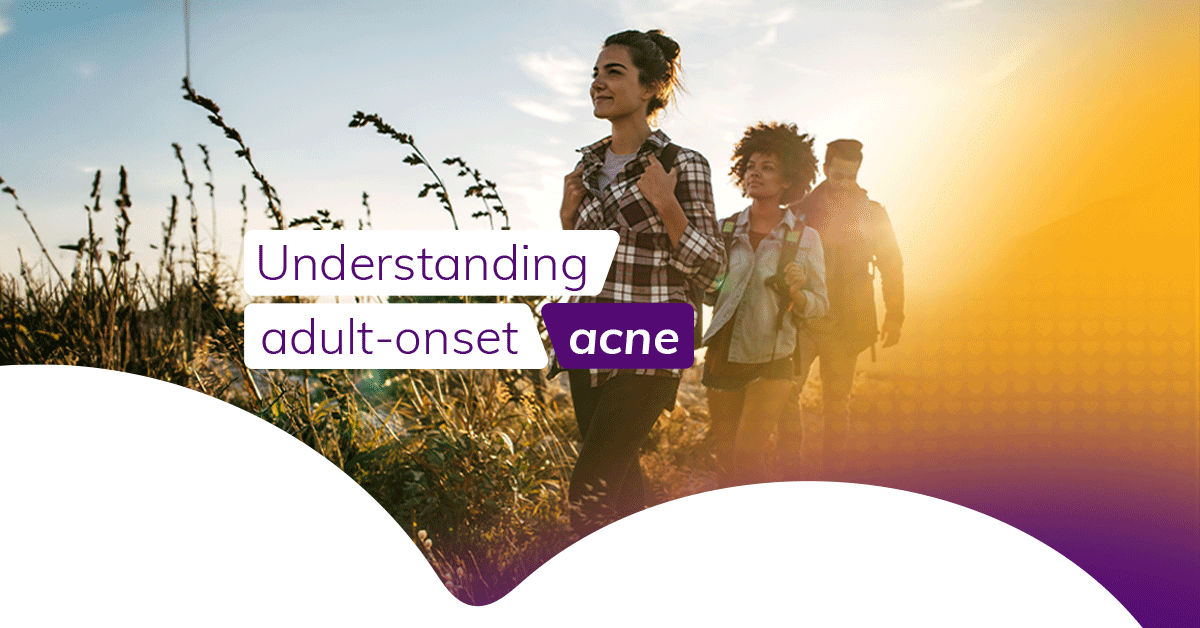 Understanding adult-onset acne